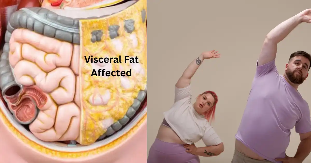 Visceral Fat Loss Gym in Vadavalli, Coimbatore | VFit Gym